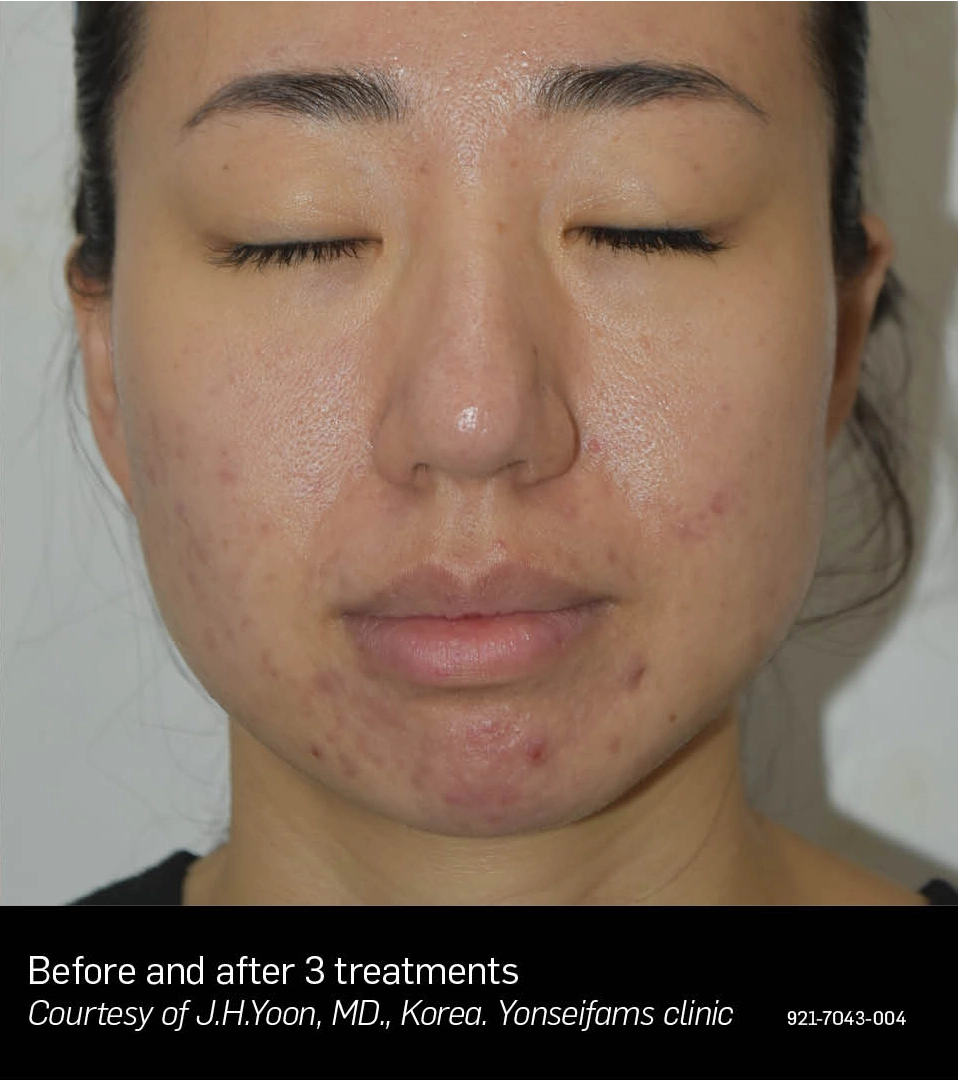 ElateAesthetics_JHYoon_A