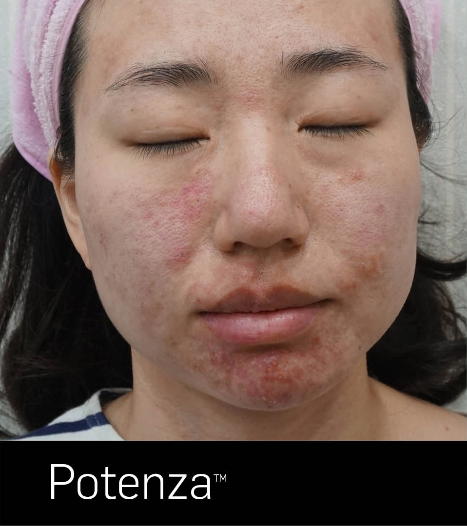 ElateAesthetics_JHYoon_B