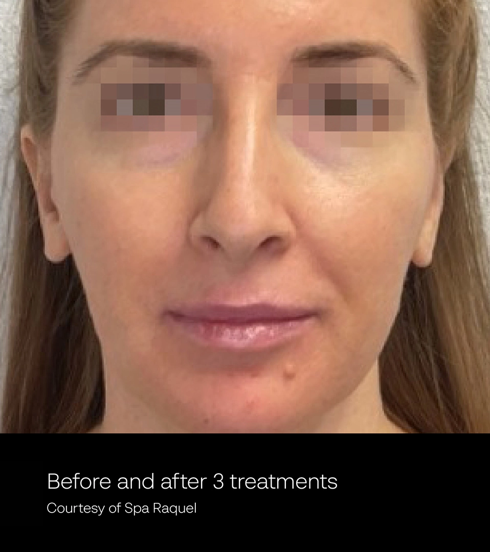 ElateAesthetics_Spa Raque2_A