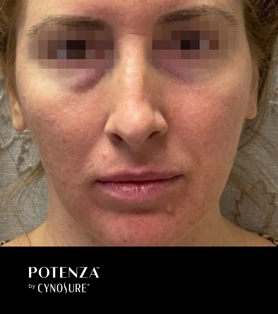 ElateAesthetics_Spa Raque2_B